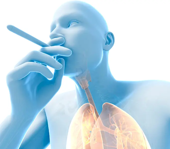 Lung Screening for Smoker