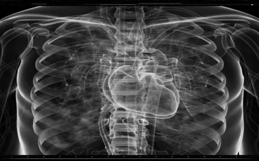 Abdominal X-Ray