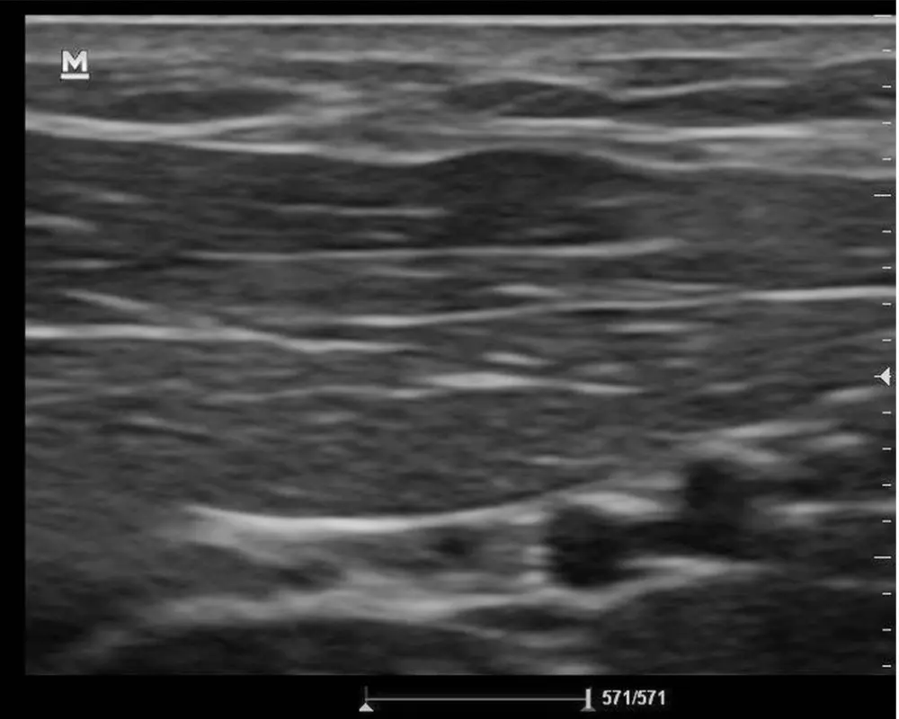 Soft Tissue Ultrasound