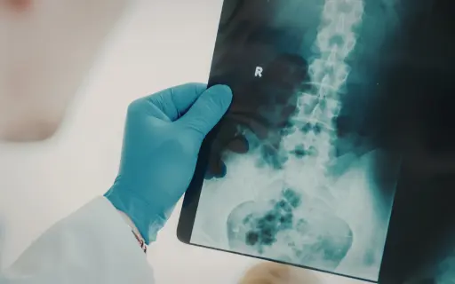 Spine X-Ray