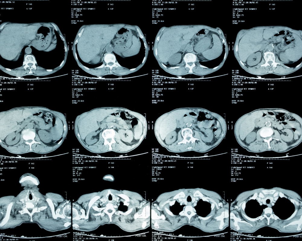 Abdominal MRI in Houston TX