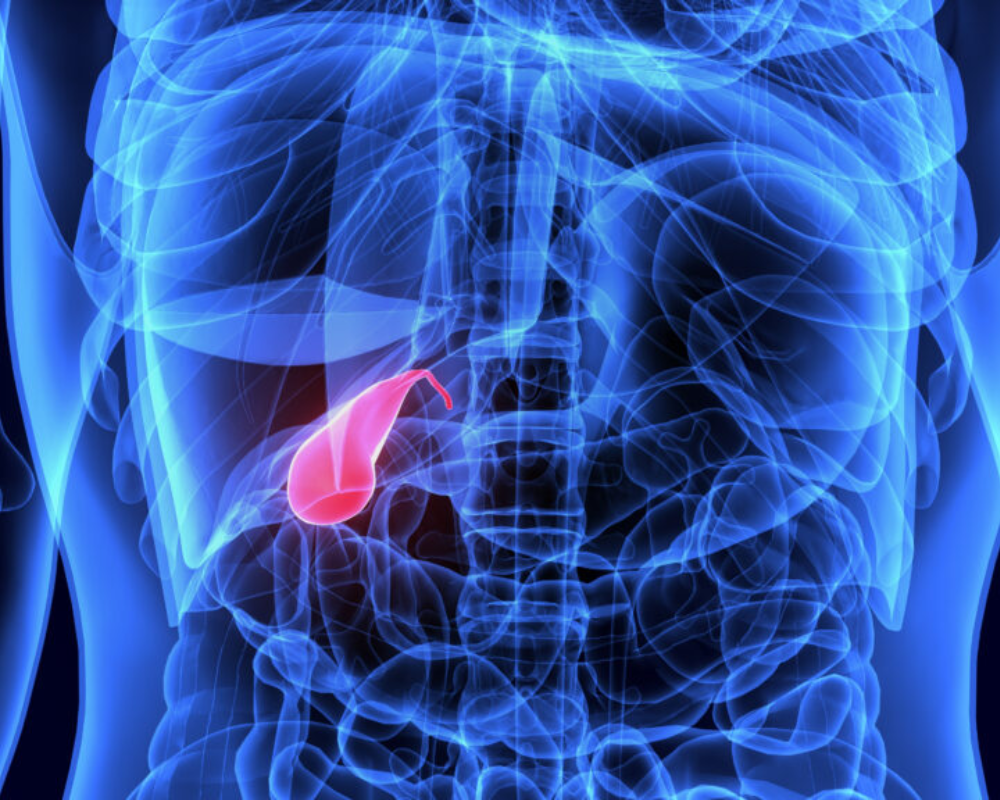 Gallbladder Conditions
