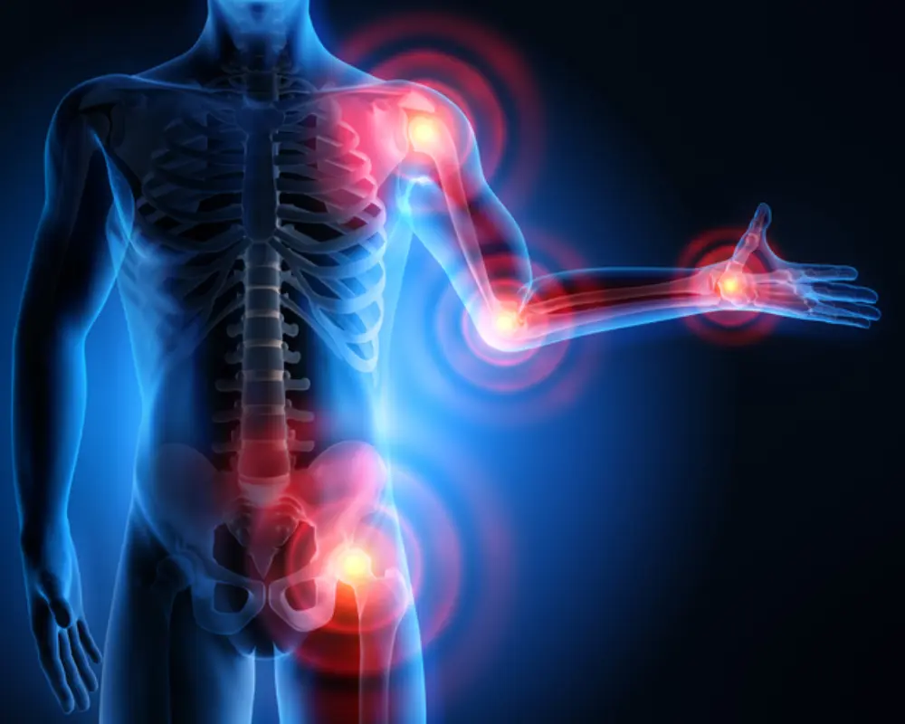 Joint Inflammation Issues