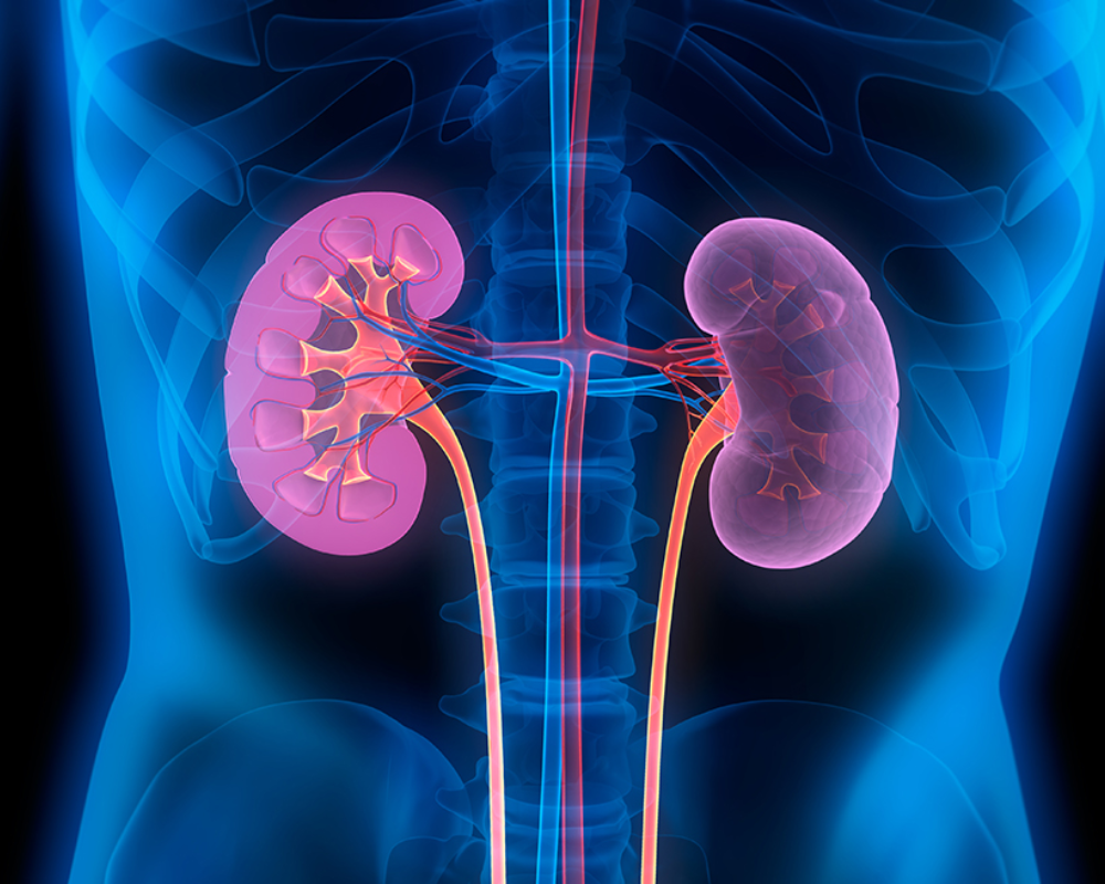 Kidney Abnormalities