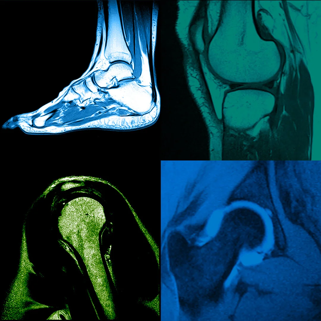 Musculoskeletal MRI Scan