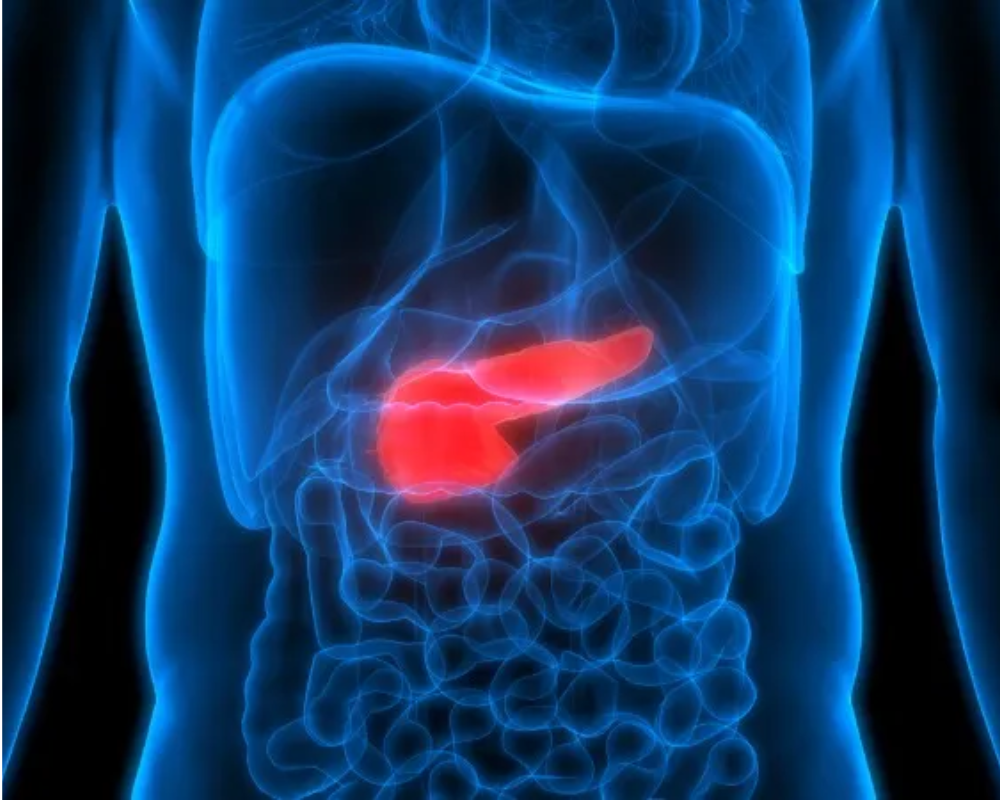 Pancreatic Disorders