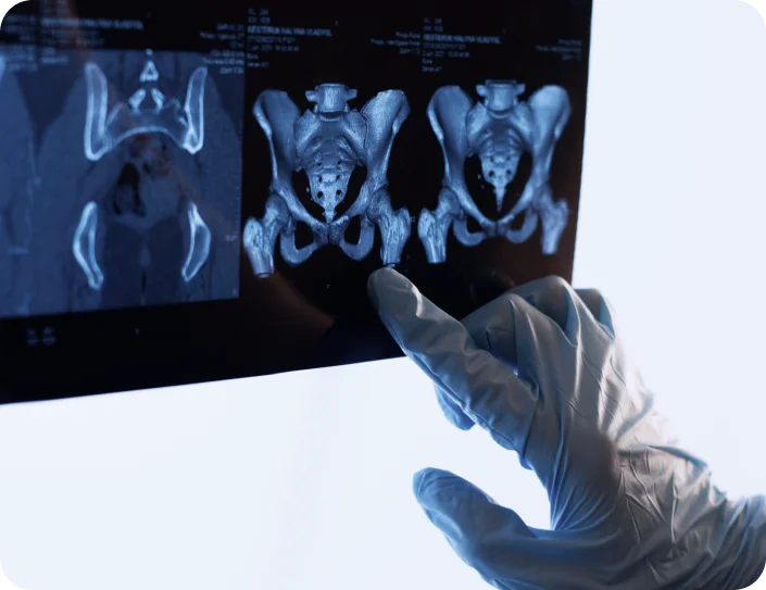 Pelvic MRI in Houston TX