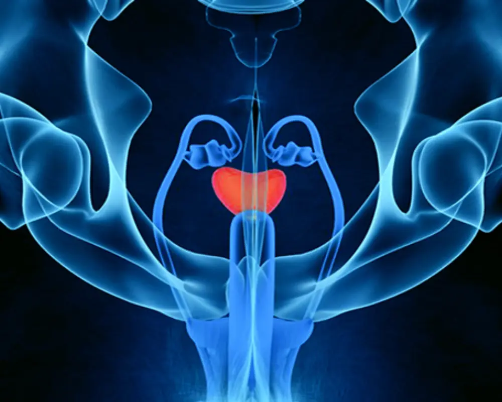 Prostate Cancer