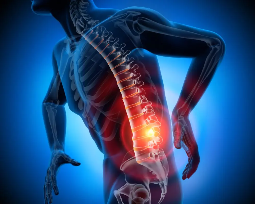 Sciatica and Nerve Pain