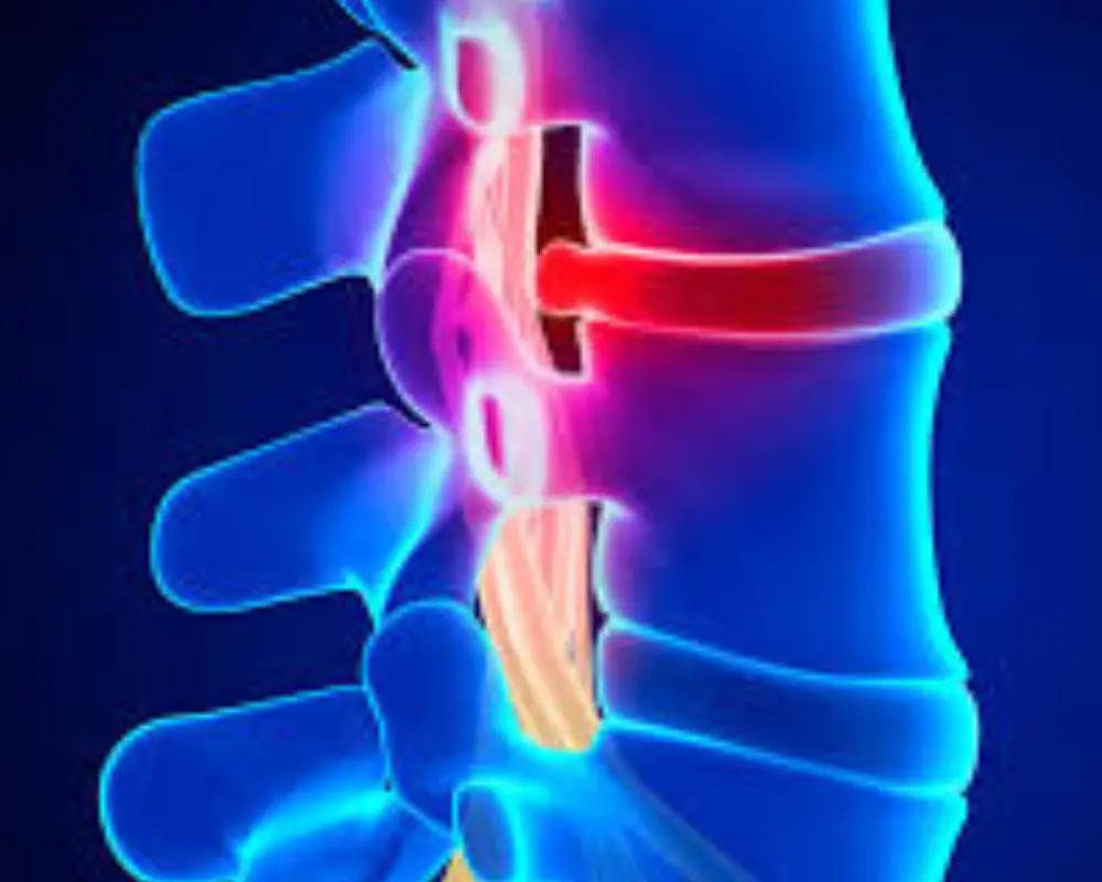 Spinal Tumors & Infections