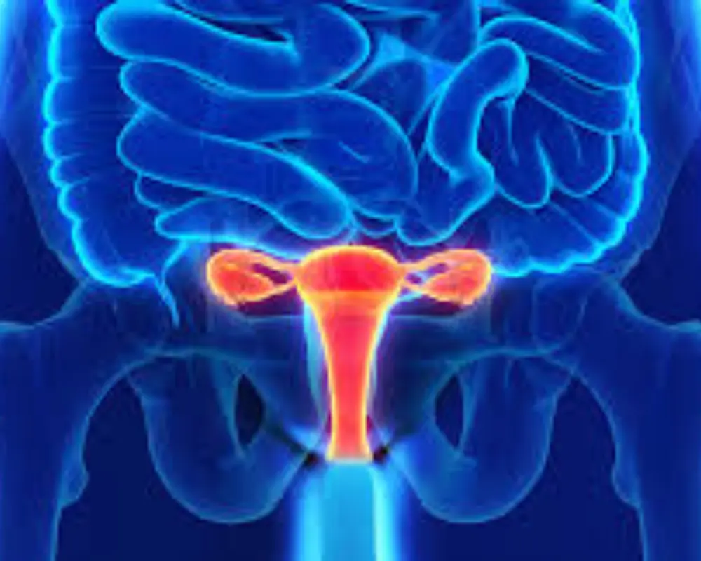 Uterine Fibroids