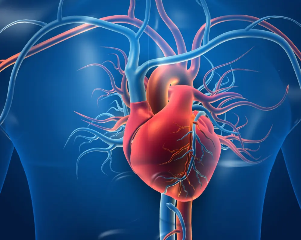 Coronary Artery Disease