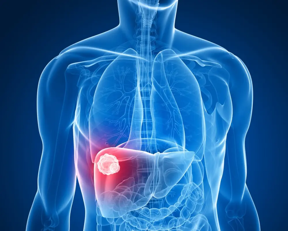 Liver Lesions